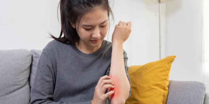 woman sitting on a couch and scratching at a red patch of sore skin on her forearm