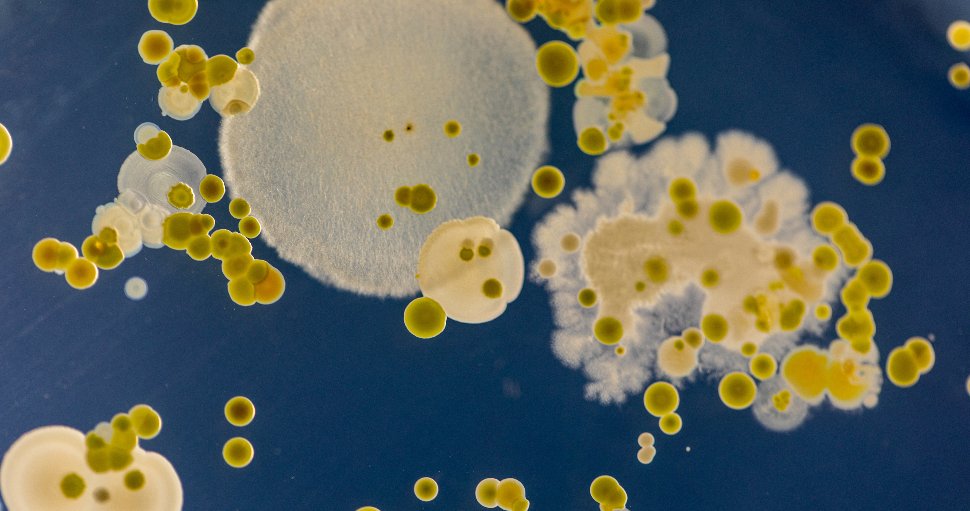 Yeast and Mould Count